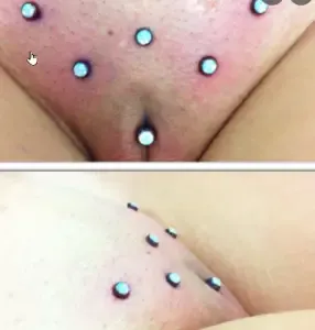 Chistina Piercing2 What is Christina piercing?